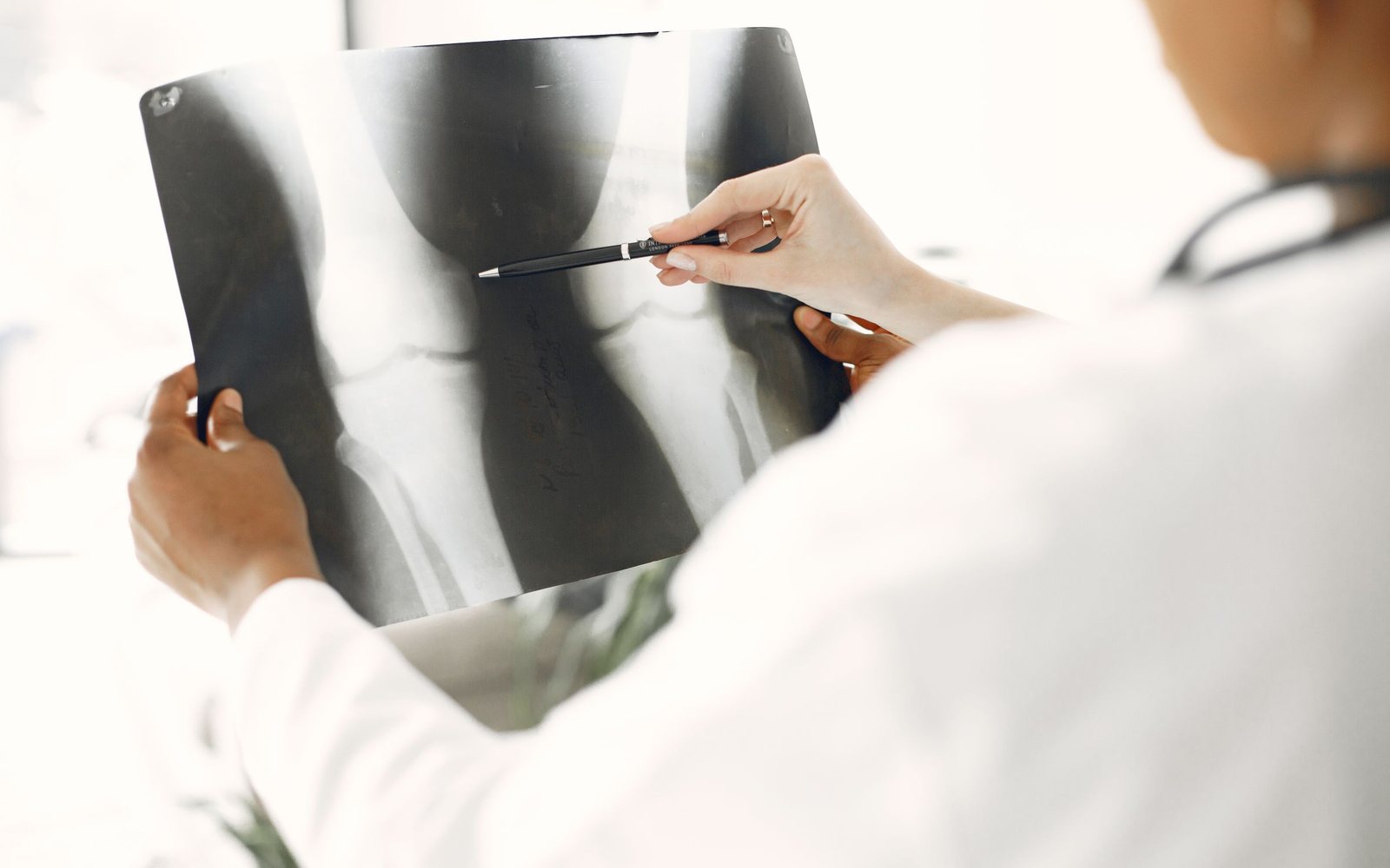O ve X Bacak (Bacak Eğriliği): Diz Kireçlenmesiyle İlişkisi ve Osteotomi